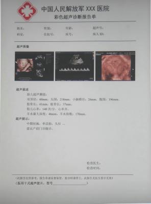 kg/jw-125醫(yī)用干式膠片