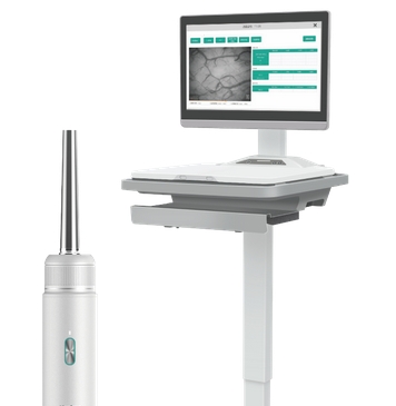 醫(yī)軟舌下微循環(huán)成像系統v260